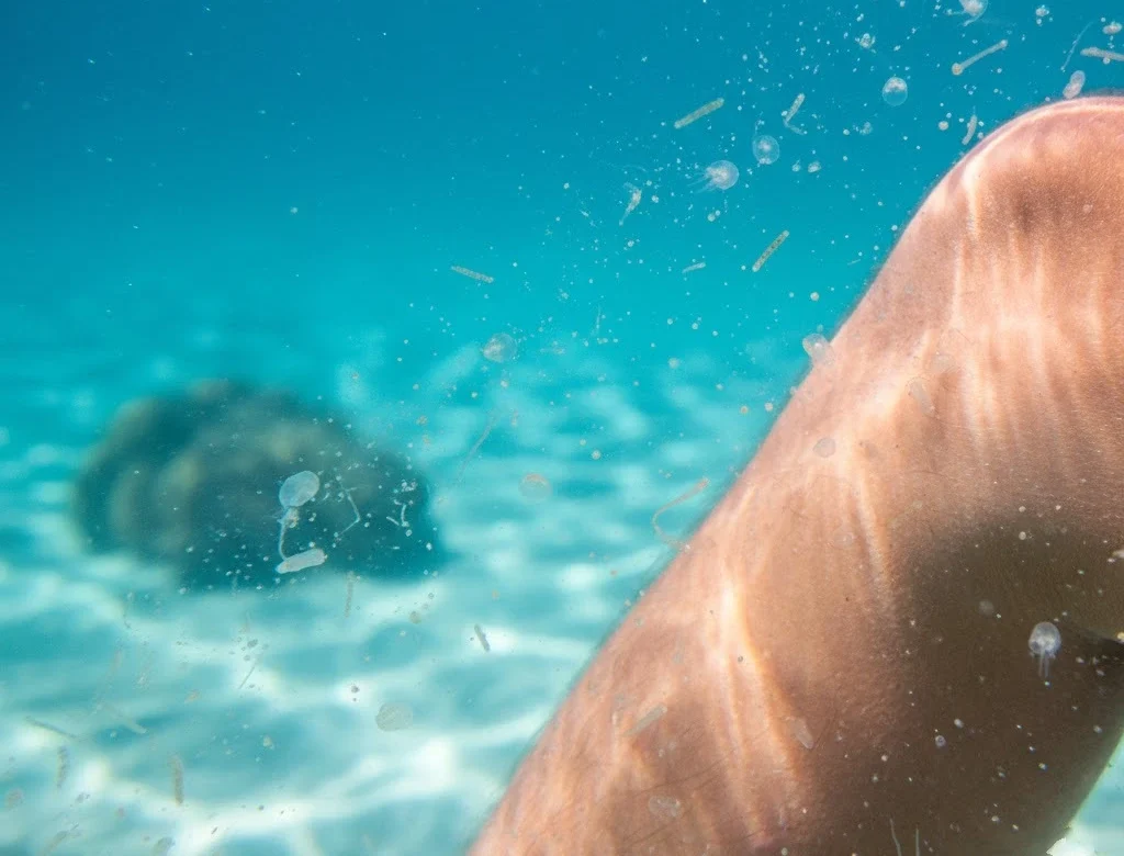 Sea lice particles near a swimmer’s leg in clear Caribbean water